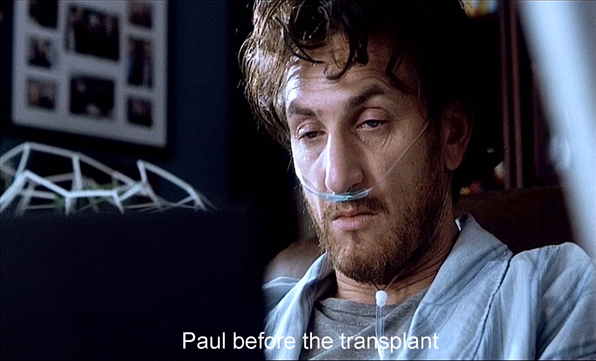 Paul before the transplant
